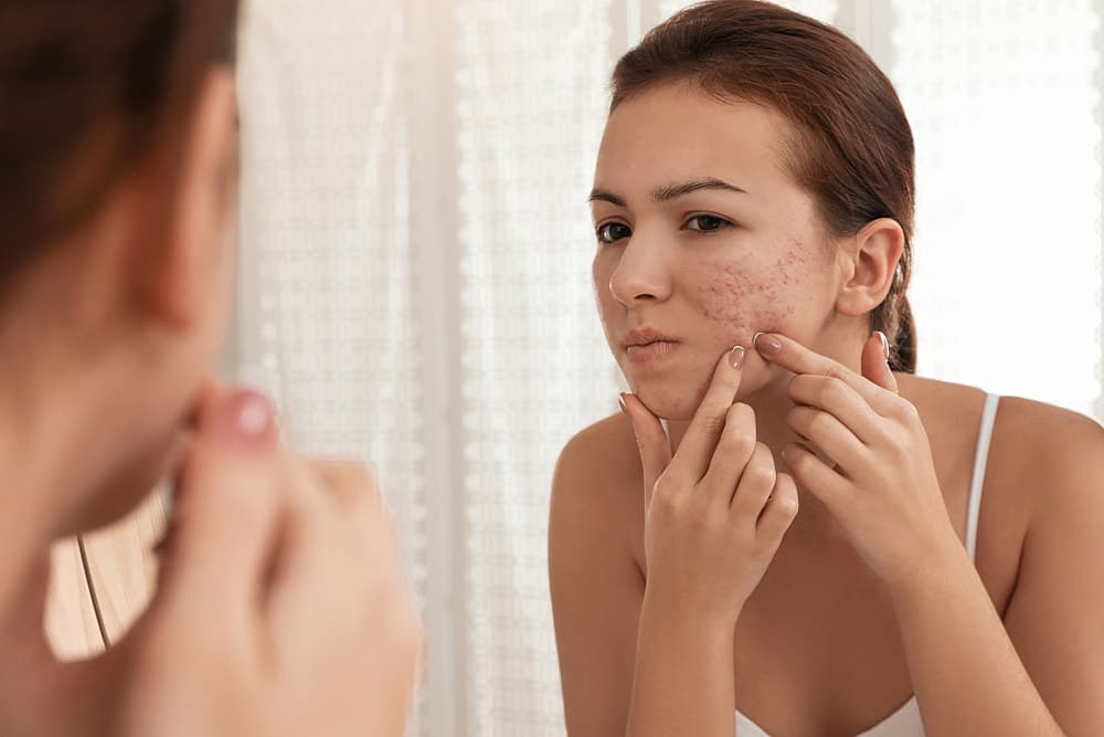 What Causes Rosacea