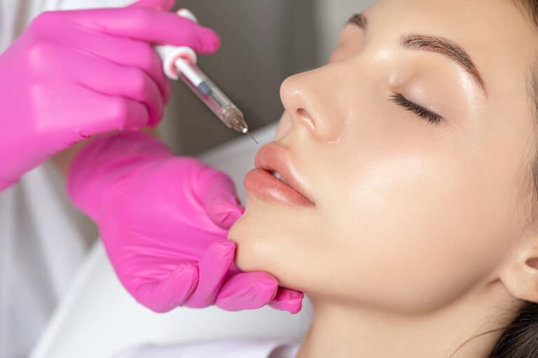 Lip Filler Guide