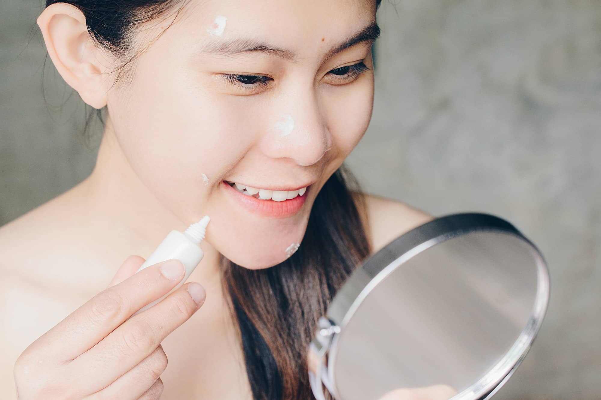 Treatment Options for Cystic Acne