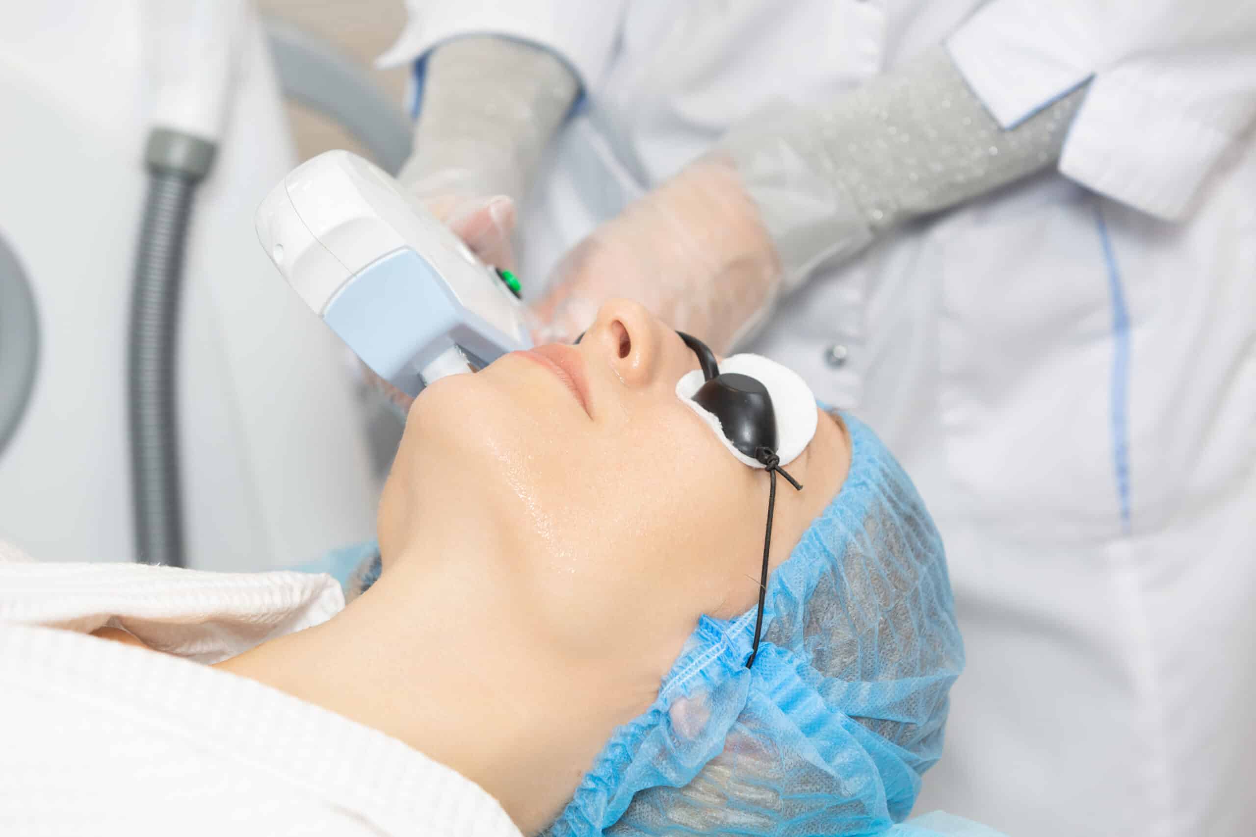 laser skin pigmentation removal singapore